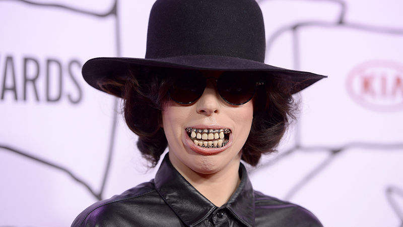 Illustration for article titled Lady Gaga's Teeth Will Give You Nightmares Forever